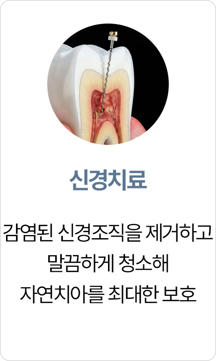 연세아크로치과 신경치료