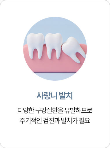 연세아크로치과 사랑니 발치