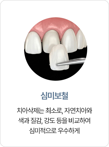 연세아크로치과 심미보철