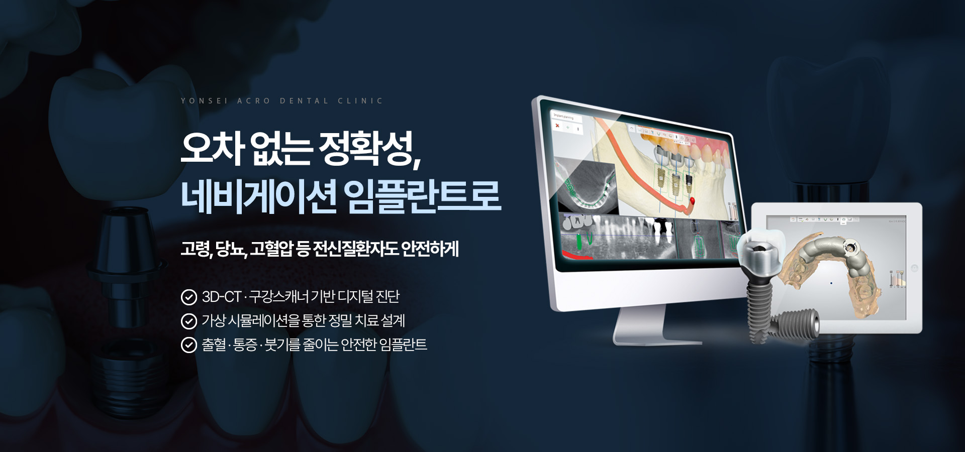 네비게이션 임플란트로 정확하고 안전한 임플란트 진료